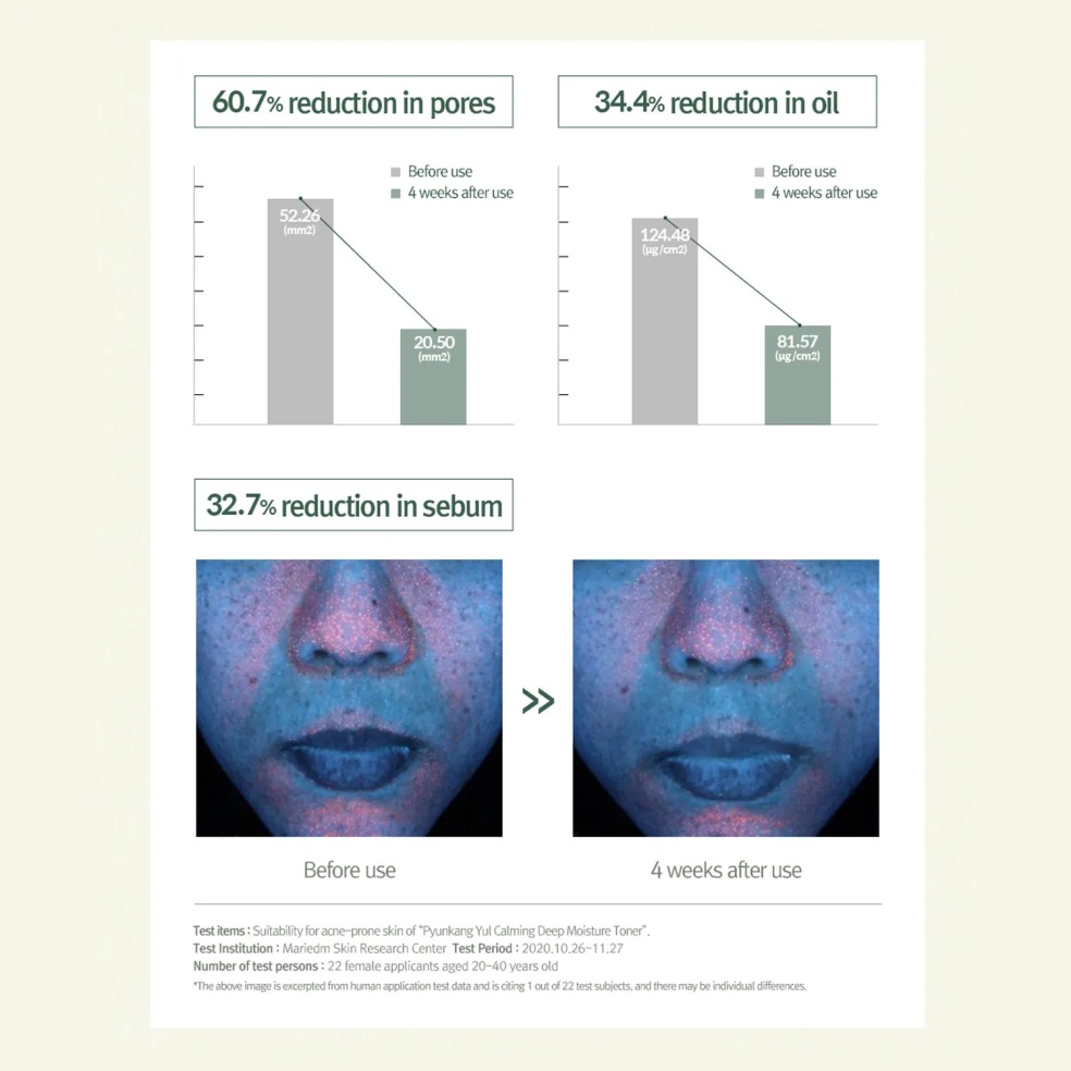 Tonique Apaisant Hydratation Profonde 150ml | Pyunkang Yul