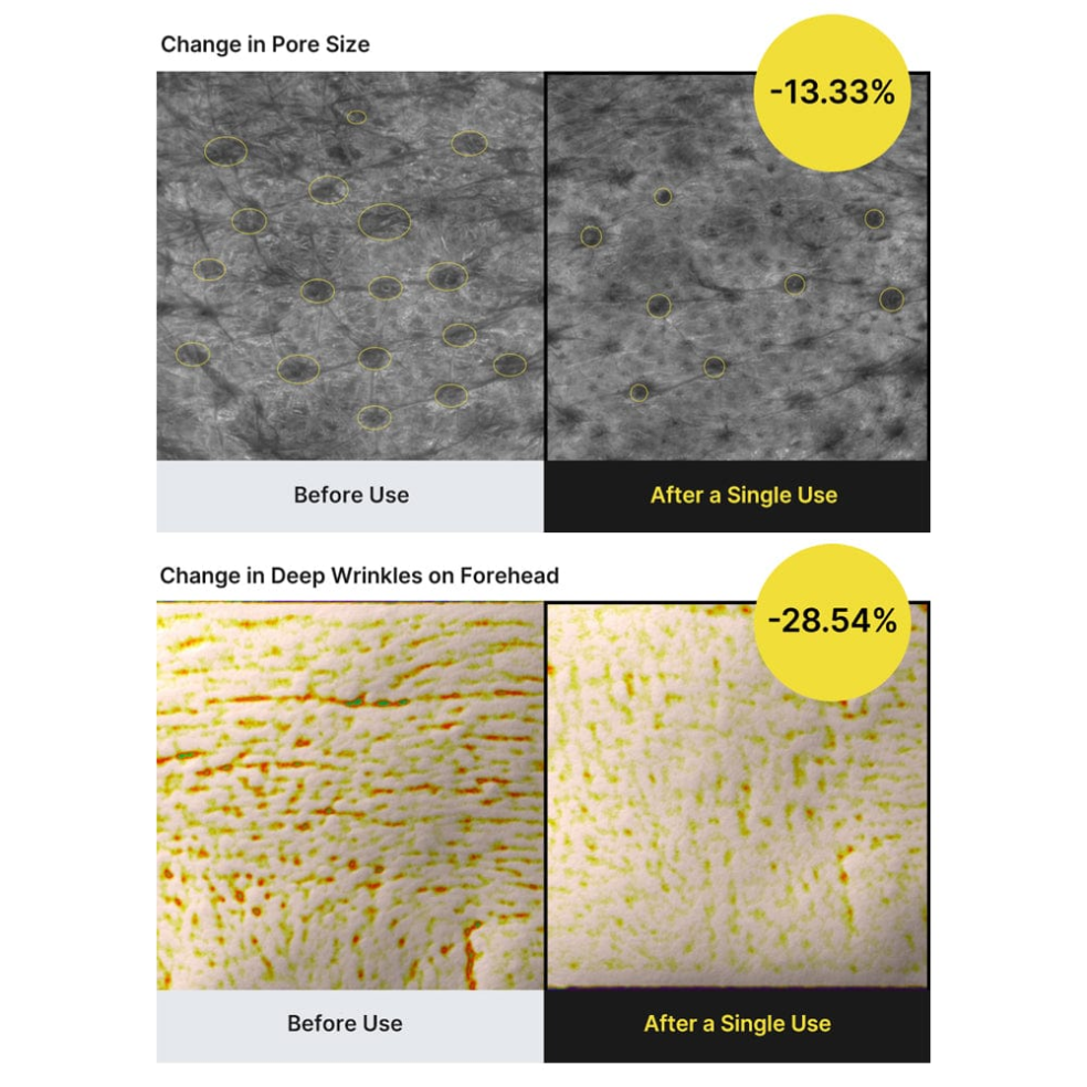 Visible results after a single use: pores and wrinkles