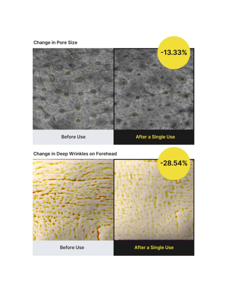 Visible results after a single use: pores and wrinkles