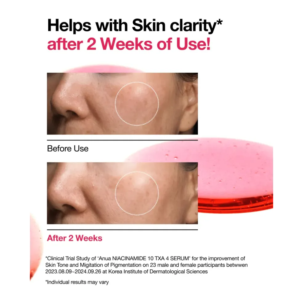 Niacinamide 10% + TXA 4% Serum - Anua